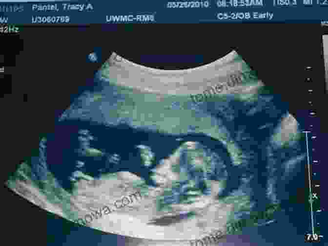 Ultrasound Image Of A 12 Week Old Fetus I M Pregnant (Through My Eyes 2)